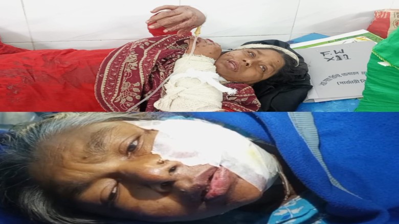 অটোগাড়ি চোর শনাক্ত করায় হাইমচরে দু’ নারীকে এলোপাতাড়ি কুপিয়ে 